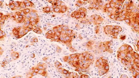 Can Donations Transform Cancer Into a Manageable Disease?