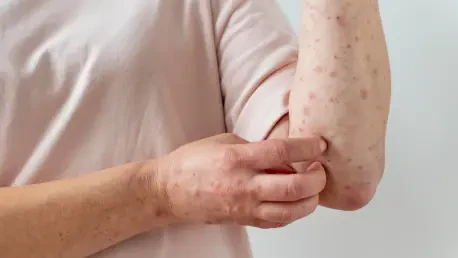 B. Abortus Dominates Brucellosis in Cameroon’s Livestock